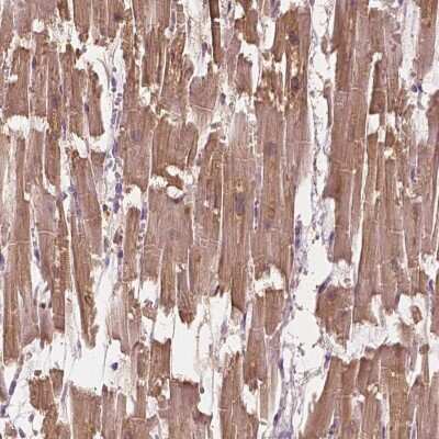 Immunohistochemistry-Paraffin: MYOM1 Antibody [NBP1-86460]