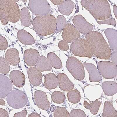 Immunohistochemistry-Paraffin: MYOM1 Antibody [NBP1-86460]