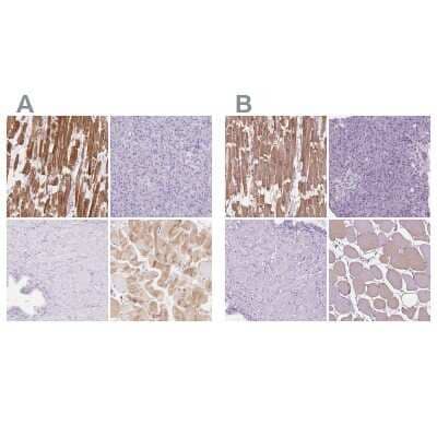 Immunohistochemistry-Paraffin: MYOM1 Antibody [NBP2-38603]