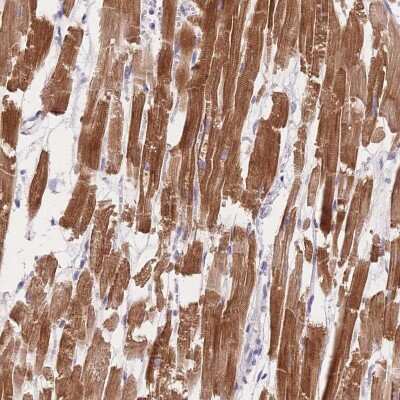 Immunohistochemistry-Paraffin: MYOM1 Antibody [NBP2-38603]