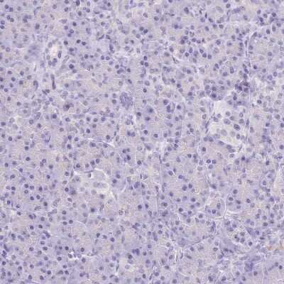 Immunohistochemistry-Paraffin: MYOM1 Antibody [NBP2-38603]