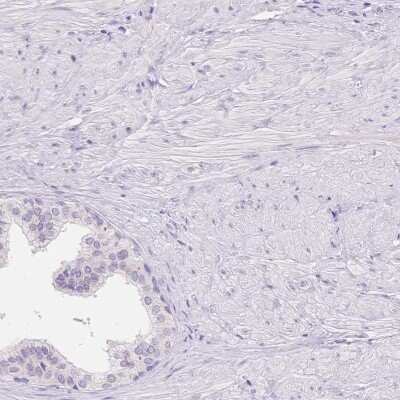 Immunohistochemistry-Paraffin: MYOM1 Antibody [NBP2-38603]