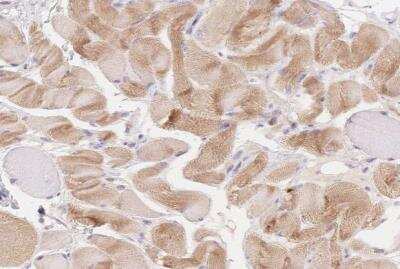 Immunohistochemistry-Paraffin: MYOM1 Antibody [NBP2-38603]