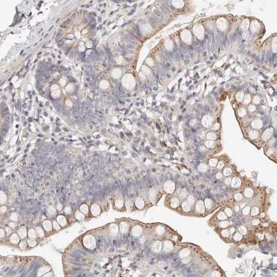 Immunohistochemistry-Paraffin: MYOM3 Antibody [NBP1-81960]