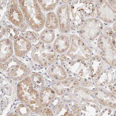 Immunohistochemistry-Paraffin: MYOM3 Antibody [NBP1-81961]