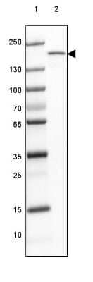 Western Blot: MYOM3 Antibody [NBP1-81961]