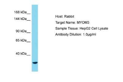 Western Blot: MYOM3 Antibody [NBP2-85348]