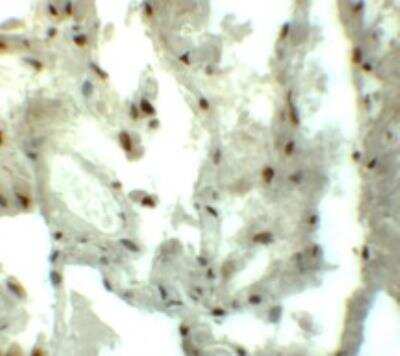 Immunohistochemistry: MYOZAP Antibody - BSA Free [NBP1-76547]