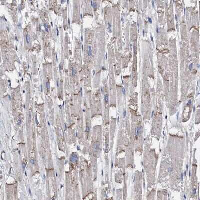 Immunohistochemistry-Paraffin: MYOZAP Antibody [NBP1-82031]