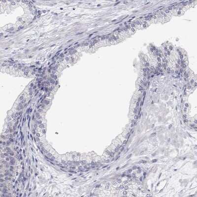 Immunohistochemistry-Paraffin: MYPN Antibody [NBP2-38924]