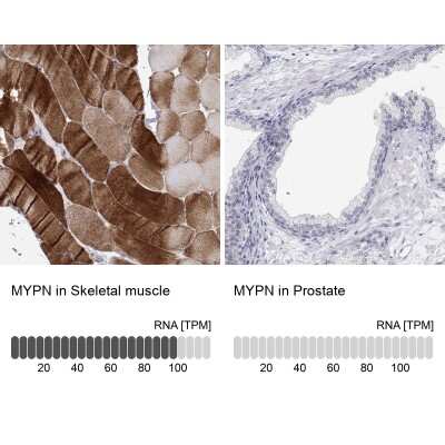 Immunohistochemistry-Paraffin: MYPN Antibody [NBP2-38924]