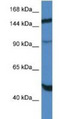 Western Blot: MYPN Antibody [NBP1-79809]