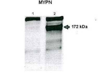 Western Blot: MYPN Antibody [NBP1-79809]