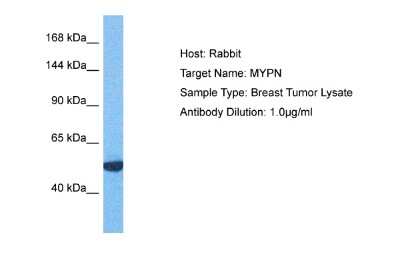 Western Blot: MYPN Antibody [NBP2-87868]