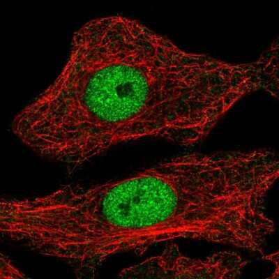 Immunocytochemistry/ Immunofluorescence: MYPOP Antibody [NBP2-55767]