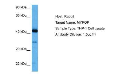 Western Blot: MYPOP Antibody [NBP2-83249]