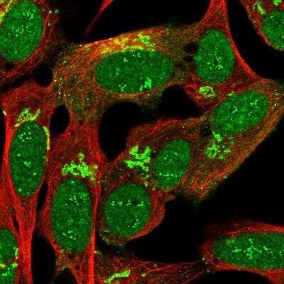 Immunocytochemistry/ Immunofluorescence: MYRIP Antibody [NBP1-84137]