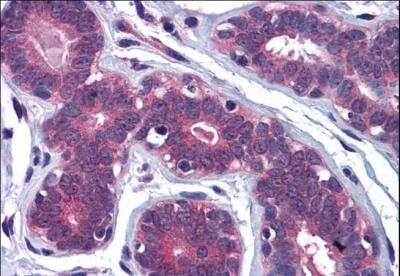 Immunohistochemistry-Paraffin: MYRIP Antibody [NB100-1278]