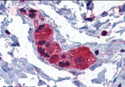 Immunohistochemistry-Paraffin: MYRIP Antibody [NB100-1278]