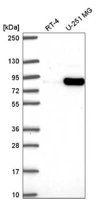 Western Blot: MYSM1 Antibody [NBP2-57859]