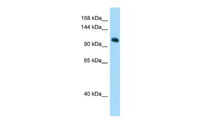 Western Blot: MYSM1 Antibody [NBP2-85354]