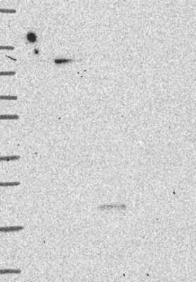 Western Blot: MYSM1 Antibody [NBP3-17396]