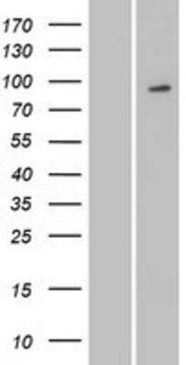 Western Blot: MYSM1 Overexpression Lysate [NBP2-08440]