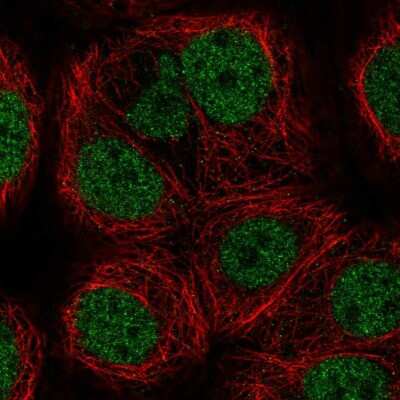 Immunocytochemistry/ Immunofluorescence: MYST1 Antibody [NBP2-56864]