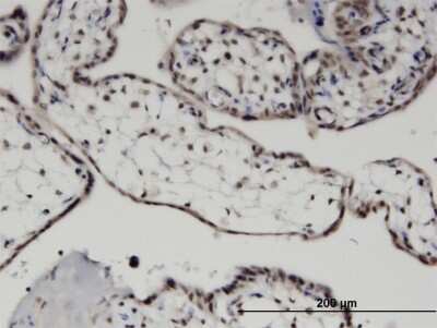 Immunohistochemistry-Paraffin: MYST3 Antibody (4D8) [H00007994-M07]