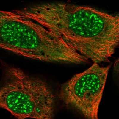 Immunocytochemistry/ Immunofluorescence: MYST3 Antibody [NBP2-57745]