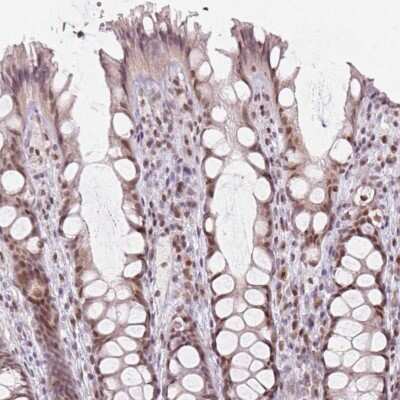 Immunohistochemistry-Paraffin: MYST3 Antibody [NBP2-56972]