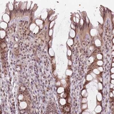 Immunohistochemistry-Paraffin: MYST3 Antibody [NBP2-57745]
