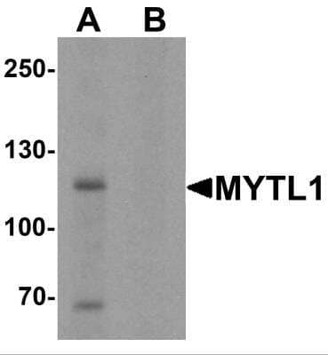 Western Blot: MYT1L AntibodyBSA Free [NBP2-81742]