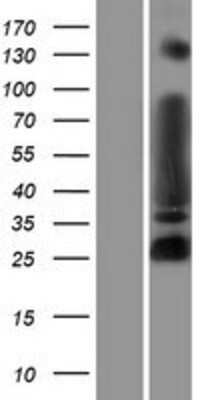 Western Blot: MYT1L Overexpression Lysate [NBP2-07219]