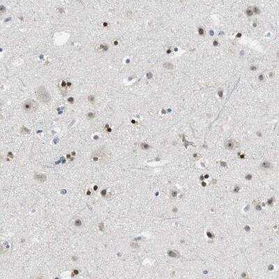 Immunohistochemistry-Paraffin: MZF1 Antibody [NBP1-82605]