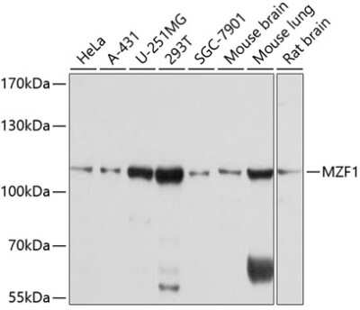 Western Blot: MZF1 AntibodyAzide and BSA Free [NBP2-93459]