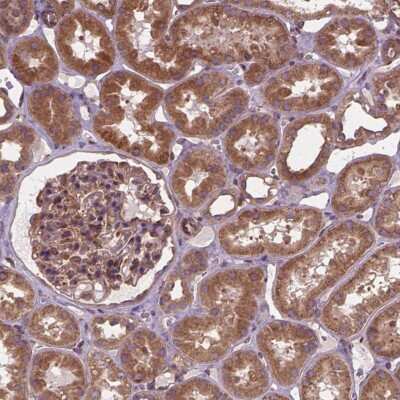 Immunohistochemistry-Paraffin: MZT1 Antibody [NBP2-49489]