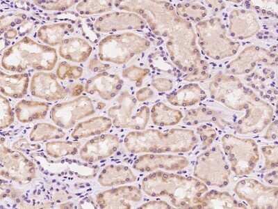 Immunohistochemistry-Paraffin: MZT1 Antibody [NBP2-98528]