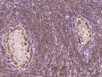 Immunohistochemistry: MZT2A Antibody [NBP3-06012]