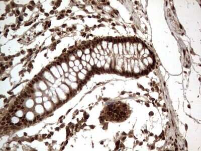 Immunohistochemistry: Macro H2A.2 Antibody (OTI1C2) [NBP2-45930]