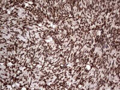 Immunohistochemistry: Macro H2A.2 Antibody (OTI1C2) [NBP2-45930]