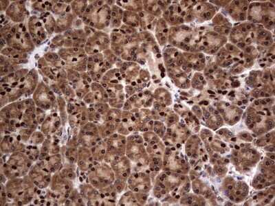 Immunohistochemistry: Macro H2A.2 Antibody (OTI1C2) [NBP2-45930]