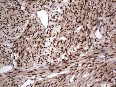 Immunohistochemistry: Macro H2A.2 Antibody (OTI1C2) [NBP2-45930]