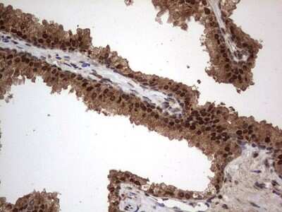 Immunohistochemistry: Macro H2A.2 Antibody (OTI1C2) [NBP2-45930]
