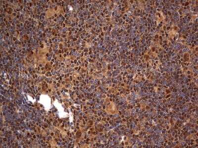 Immunohistochemistry: Macro H2A.2 Antibody (OTI1C2) [NBP2-45930]