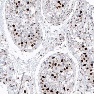 Immunohistochemistry: Macro H2A.2 Antibody (CL5263) [NBP2-61156]
