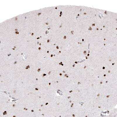 Immunohistochemistry: Macro H2A.2 Antibody (CL5263) [NBP2-61156]