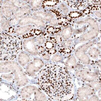 Immunohistochemistry: Macro H2A.2 Antibody (CL5263) [NBP2-61156]