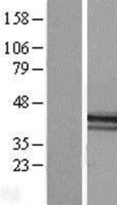 Western Blot: Macro H2A.2 Overexpression Lysate [NBL1-11426]