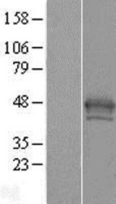 Western Blot: Histone H2AY/macroH2A.1 Overexpression Lysate [NBP2-11197]